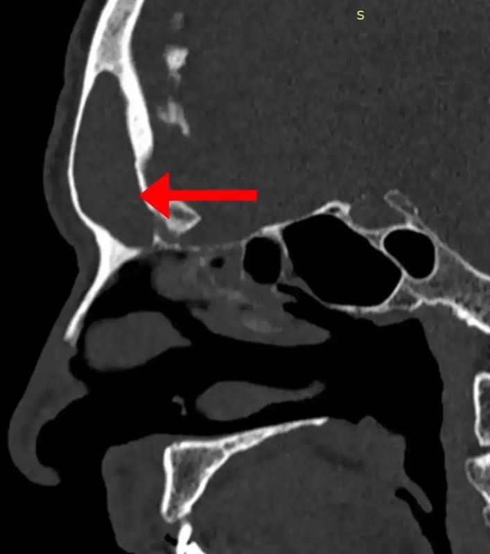 �������� � ������ ���������� �������������� � ��� �1