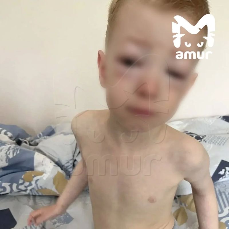 Малыш едва не умер после обеда в детском саду Хабаровска Малыш едва не умер после обеда в детском саду Хабаровска