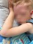 Ребенок едва не умер от аллергии в хабаровском детском саду