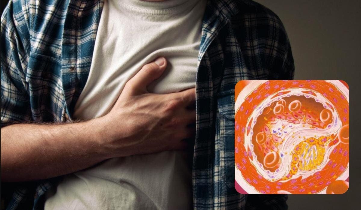 Чем грозят жареные продукты: худшая еда для вашего сердца