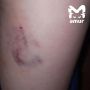 Агрессивная собака регулярно нападает на детей в Хабаровске